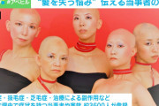 「髪がない＝かわいそうではない」30年隠してきた“抜毛症”当事者の訴え #社会