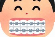 歯列矯正してる奴ちょっとこい