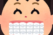 【画像】歯列矯正を3ヶ月ちょいやった結果がすごすぎるwwwwwwwww　