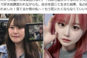 整形総額1300万円超、32歳YouTuberが今昔比較　アンチコメに負けず「私の好きな私になれました！」