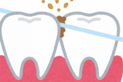 最近歯間フロス使い始めたんやが