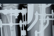 【悲報】新たに発見された骨延長患者さん、身体がボロボロになってしまう…