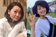 【悲報】整形地獄にハマった元アイドルの主張が悲惨すぎる・・・