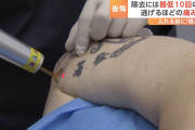 韓国人の反応「タトゥーに後悔して除去する人が激増！？　」