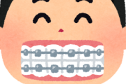 【悲報】歯の矯正ガチでつらい…
