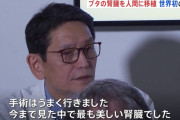 末期腎不全患者にブタ腎臓の移植成功　医師「将来的に人工透析はなくなる」
