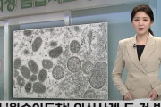 韓国でサル痘感染疑い事例、2件を初確認