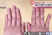 【画像】「スマホ指」、ガチで社会問題へ