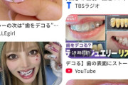 【画像】歯をデコるブーム到来。これ半分食べカスだろｗｗｗｗ