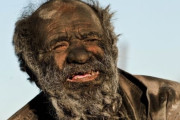 【画像】60年間身体を洗ったことのない男の見た目が凄いｗｗｗｗｗｗｗｗｗｗｗ