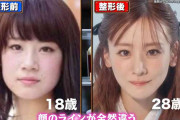 整形に6000万円以上のモデル・福岡みなみ、バレない埋没二重の4つのポイント紹介「無理に左右対称にしない」