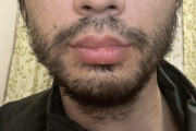 マスク生活で髭剃りを怠った結果wwwwwwwww