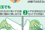 【画像】指に刺さったトゲは心臓まで行く？？ → その衝撃結果・・・