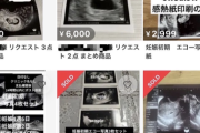 【悲報】メルカリ、胎児のエコー写真の出品禁止
