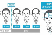 【画像】薄毛の境界線に激震！？薄毛の認定ラインが7cmから6cmに