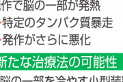 【朗報】”てんかん”が悪化する仕組み、解明される　群馬大『脳の熱暴走です』