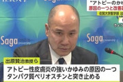 【超朗報】佐賀大学さん、アトピーを無くしてしまうかもしれない「”かゆみ”の原因を解明した。治療薬作る」