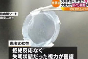 【素晴らしい】失明状態の女性が視力回復！ 大阪大がｉＰＳ細胞角膜移植手術に成功！