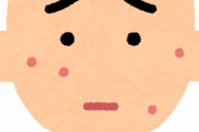 【悲報】ワイ「ニキビ治らない」お前ら「顔洗え」「皮膚科行け」→結果ｗｗｗｗｗｗ
