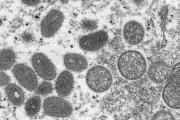 【WHO】ヨーロッパでサル痘が急拡大、既に100人超が感染か…同じパーティーに出席で感染
