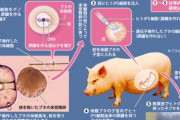 ヒト種さん、豚の腎臓を移植して延命出来る技術を成功させてしまう