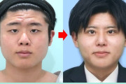 “全顔整形”でスーパーイケメンに生まれ変わった男性がこちらです