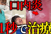 【急募】口内炎をすぐ治す方法