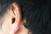 【悲報】イヤホンのし過ぎで外耳道炎と診断される