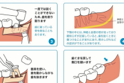 歯医者「親知らず抜いた方がいいかもね」　今日これ言われたんやが