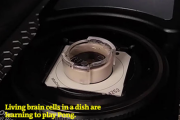 実験室で培養した「ミニ脳」、ゲームのプレイに成功　胎児レベルの意識も