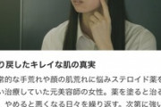 【ステロイド】日テレ「世界仰天ニュース」放送内容を謝罪…日本皮膚科学会が抗議文