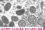 成田空港に到着した男性のサル痘陽性が判明 「空港で相談してくれたので早期に診断ができた」❓❓