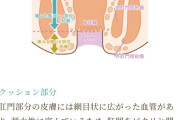 【朗報】「肛門ボトックス」が話題に