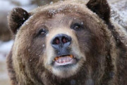 クマに顔を引っかかれた人のCT画像、ガチでヤバすぎる・・・((((；ﾟДﾟ))))