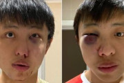 海外「コロナウイルスレイシズム、イギリスでシンガポール人の学生がリンチされる」