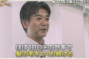 俺の髪の毛が帰ってきた？最新の毛髪再生医療ｗｗｗ