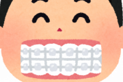 ワイ「歯列矯正？やりたいけど高いからなぁ」友達「月1万5000円で歯列矯正したわーw」