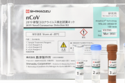 【朗報】島津製作所が新型コロナウイルス検出試薬キットを開発…１時間でコロナ感染を判定