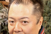 【悲報】ブラマヨ小杉さん、ハゲる寸前
