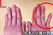 【画像】『スマホ指』 ガチで怖い