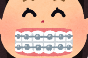 彼女に歯列矯正させる方法ｗｗｗｗｗｗｗ