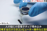 【脳チップ】イーロン・マスクのニューラリンク社、人間の脳にチップを埋め込む手術を初めておこなったと発表
