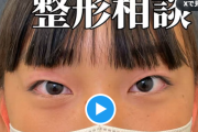 女子中学生（13）、二重整形で生まれ変わる！！　しかし中学生に整形する医者は糞！と叩かれる