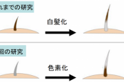 【研究】「白髪」が元に戻る！　髪はストレスの有無によって色を変えることが判明