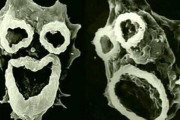 怖すぎて震える。殺人アメーバ「フォーラーネグレリア」の顕微鏡写真がまさに悪魔そのものと話題に