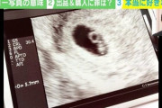 「すんげぇの売られてた」 女性が妊娠時に撮影する胎児のエコー写真がフリマサイトに出品 一体、誰がなんのために使うのか？