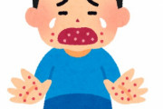 手足口病になったから症状を書いてく