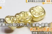 患者から取り外した「金歯」を盗んだ歯科衛生士の女を逮捕