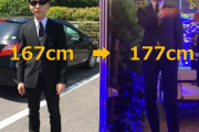 【朗報】手術で身長を10cm延ばした男、めちゃくちゃスーツが似合うようになる（※画像あり）
