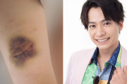 【芸能】俳優・小澤廉が元JK恋人に腹部殴打で堕胎強要、自殺寸前の救出劇！…所属事務所は報道を認め謝罪するとともに契約を解除